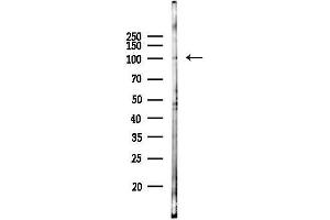 anti-Leptin Receptor (LEPR) (C-Term) antibody