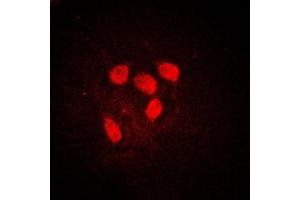 Immunofluorescent analysis of c-Myc (pS62) staining in HeLa cells. (c-MYC 抗体  (N-Term, pSer62))