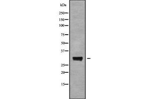Western blot analysis of AQP6 using RAW264. (AQP6 抗体  (Internal Region))
