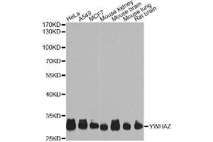Western blot analysis of extracts of various cell lines, using YWHAZ Antibody. (14-3-3 zeta 抗体  (AA 1-100))