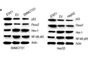 Effect of STAT1 on p53, Fbxw7, Hes-1 and NF-κB p65. (FBXW7 抗体  (AA 501-600))