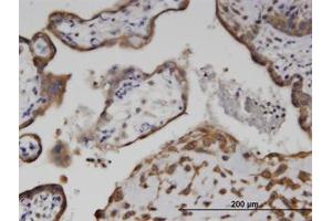 Image no. 1 for anti-Adenylate Kinase 9 (AK9) (AA 321-422) antibody (ABIN599621) (Adenylate Kinase 9 抗体  (AA 321-422))