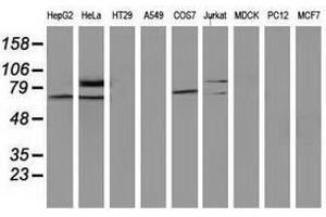 Image no. 2 for anti-SAM Domain and HD Domain 1 (SAMHD1) antibody (ABIN1500801) (SAMHD1 抗体)