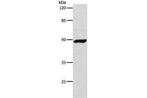 Western Blot analysis of Hela cell using DRD1 Polyclonal Antibody at dilution of 1:1000 (Dopamine Receptor d1 抗体)