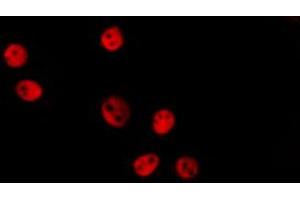 ABIN6274149 staining Hela by IF/ICC. (HMGN2 抗体  (Internal Region))