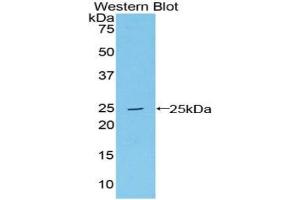Detection of Recombinant LMP7, Human using Polyclonal Antibody to Large Multifunctional Peptidase 7 (LMP7) (PSMB8 抗体  (AA 75-261))