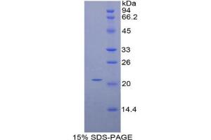 SDS-PAGE analysis of Mouse HDGF Protein. (HDGF 蛋白)