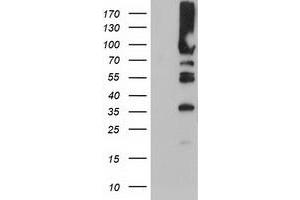 Western Blotting (WB) image for anti-phosphofructokinase, Platelet (PFKP) antibody (ABIN1500161) (PFKP 抗体)