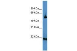 Image no. 1 for anti-Optic Atrophy 3 (Autosomal Recessive, with Chorea and Spastic Paraplegia) (OPA3) (AA 95-144) antibody (ABIN6746679)