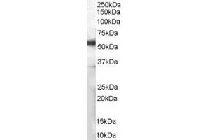 ABIN185563 (1µg/ml) staining of Human Lymph Node lysate (35µg protein in RIPA buffer). (CD14 抗体  (Internal Region))