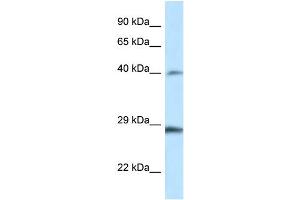 WB Suggested Anti-Hoxb9 Antibody Titration: 1. (HOXB9 抗体  (Middle Region))