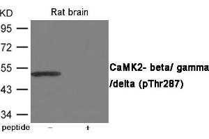 Western blot analysis of extracts from Rat brain using CaMK2- beta/ gamma/ delta (Phospho-Thr287) Antibody. (CAMK2D 抗体  (pThr287))