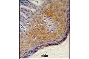 Formalin-fixed and paraffin-embedded human skin reacted with DERA Antibody (N-term), which was peroxidase-conjugated to the secondary antibody, followed by DAB staining. (DERA 抗体  (N-Term))