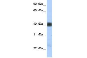 SGCB antibody used at 1 ug/ml to detect target protein. (SGCB 抗体)