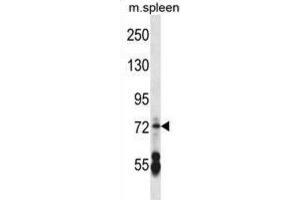 Western Blotting (WB) image for anti-Cyclic Nucleotide Gated Channel alpha 2 (CNGA2) antibody (ABIN2998018) (CNGA2 抗体)