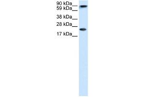 WB Suggested Anti-CBX5 Antibody Titration:  1. (CBX5 抗体  (Middle Region))
