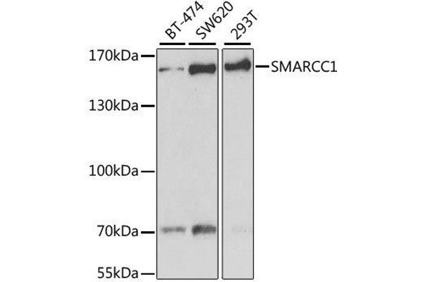 SMARCC1 抗体  (AA 80-320)