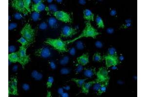 Anti-MGRN1 mouse monoclonal antibody (ABIN2454433) immunofluorescent staining of COS7 cells transiently transfected by pCMV6-ENTRY MGRN1 (RC208284). (Mahogunin RING Finger Protein 1 抗体)