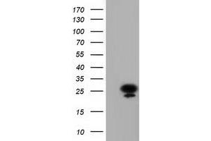 Western Blotting (WB) image for anti-Adenylate Kinase 3 (AK3) antibody (ABIN1496523) (Adenylate Kinase 3 抗体)