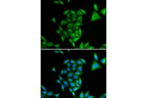 Immunofluorescence (IF) image for anti-Phytanoyl-CoA 2-Hydroxylase (PHYH) antibody (ABIN1980320) (PHYH 抗体)