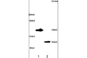 Lane 1: rat brain lysates Lane 2: rat lung lysates probed with Anti ADCY5 Polyclonal Antibody, unconjugated (ABIN751183) at 1:200 in 4 °C Followed by conjugation to secondary antibody (ABIN727474-HRP) at 1:3000 90min in 37 °C Predicted band 139kD. (ADCY5 抗体  (AA 857-909))