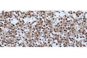 Immunohistochemistry of paraffin-embedded Human tonsil tissue using CELF5 Polyclonal Antibody at dilution of 1:65(x200) (CELF5 抗体)