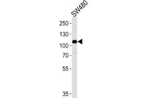 Western Blotting (WB) image for anti-Mitogen-Activated Protein Kinase Kinase Kinase 9 (MAP3K9) antibody (ABIN3003606) (MAP3K9 抗体)