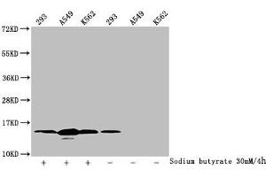 Western Blot Detected samples: 293 whole cell lysate, A549 whole cell lysate, K562 whole cell lysate, Untreated (-) or treated (+) with 30 mM sodium butyrate for 4h All lanes: HIST1H2BC antibody at 1:100 Secondary Goat polyclonal to rabbit IgG at 1/50000 dilution Predicted band size: 14 kDa Observed band size: 14 kDa (Histone H2B 抗体  (acLys12))