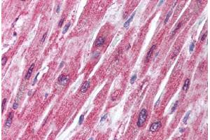 Human Heart (formalin-fixed, paraffin-embedded) stained with TRAF2 antibody ABIN214009 at 5 ug/ml followed by biotinylated goat anti-rabbit IgG secondary antibody ABIN481713, alkaline phosphatase-streptavidin and chromogen. (TRAF2 抗体  (N-Term))