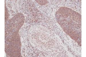 Image no. 1 for anti-Colony Stimulating Factor 2 (Granulocyte-Macrophage) (CSF2) antibody (ABIN465582) (GM-CSF 抗体)