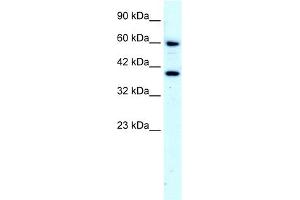 WB Suggested Anti-RORA Antibody Titration:  4.