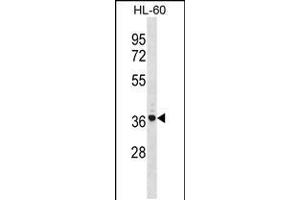Western blot analysis in HL-60 cell line lysates (35ug/lane). (TNIP2 抗体  (AA 165-194))