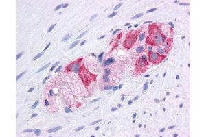 Immunohistochemistry (IHC) image for anti-Heat Shock Protein 90kDa alpha (Cytosolic), Class A Member 1 (HSP90AA1) (AA 108-157) antibody (ABIN6745698)
