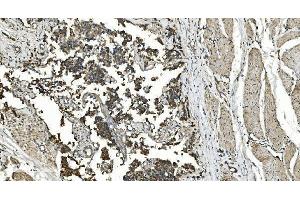 IHC analysis of FLCN using anti-FLCN antibody (ABIN7602491). (FLCN 抗体  (AA 8-551))