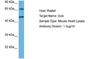 Western Blotting (WB) image for anti-Glutamate-Cysteine Ligase, Catalytic Subunit (GCLC) (N-Term) antibody (ABIN2774078)