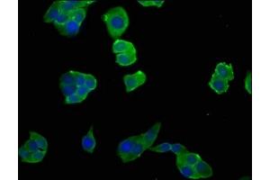 Immunofluorescence staining of PC-3 cells with ABIN7151823 at 1:50, counter-stained with DAPI. (NGEF 抗体  (AA 495-710))