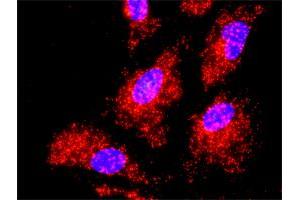 Proximity Ligation Analysis of protein-protein interactions between IKBKB and TRAF2. (TRAF2 抗体  (AA 1-501))