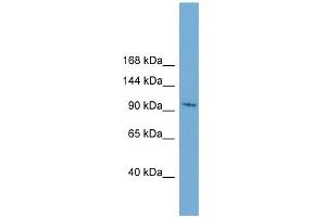 WB Suggested Anti-STK31 Antibody Titration:  0. (STK31 抗体  (N-Term))