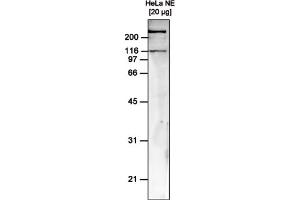 Western Blot of anti-hSNF2H antibody Western Blot results of mouse anti-hSNF2H antibody. (SMARCA5 抗体)