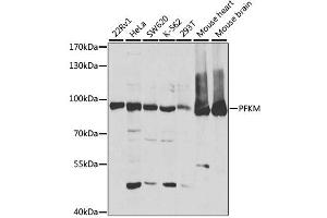 Western blot analysis of extracts of various cell lines, using PFKM antibody (ABIN1876665) at 1:1000 dilution. (PFKM 抗体)