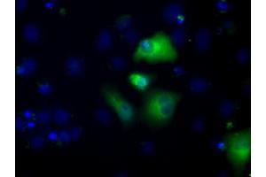 Image no. 2 for anti-Aldehyde Dehydrogenase 3 Family, Member A1 (ALDH3A1) antibody (ABIN1496591) (ALDH3A1 抗体)