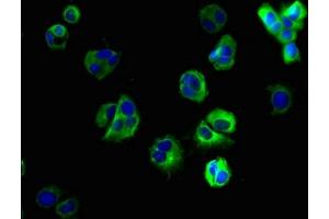 Immunofluorescent analysis of MCF-7 cells using ABIN7170239 at dilution of 1:100 and Alexa Fluor 488-congugated AffiniPure Goat Anti-Rabbit IgG(H+L) (SLC35F6 抗体  (AA 337-371))