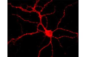 Immunofluorescence labeling of a hippocampus neuron (dilution 1 : 1000). (Dynamin 3 抗体  (AA 773-794))