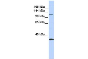 WB Suggested Anti-MCM2 Antibody Titration:  0. (MCM2 抗体  (Middle Region))