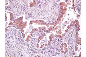 Immunohistochemistry (IHC) image for anti-Protein Kinase, AMP-Activated, beta 1 Non-Catalytic Subunit (PRKAB1) (AA 201-272) antibody (ABIN751858)
