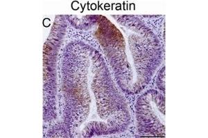 Immunohistochemical staining of tumor biopsy and biopsy spheroid sections.