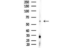 Western blot analysis of lysates from HepG2 cells(LPS, 4h treatment), using Cytokeratin 6a Antibody at 1/1000 dilution.