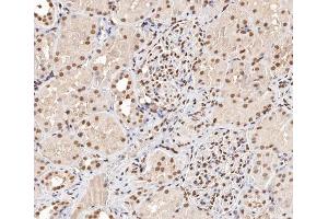 ABIN6267404 at 1/200 staining human kidney tissue sections by IHC-P. (Stathmin 1 抗体  (pSer15))