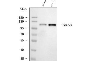 Western blot analysis of THBS3 using anti-THBS3 antibody (ABIN7600759). (THBS3 抗体  (AA 23-486))