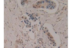 Immunohistochemistry (IHC) image for anti-Copper Chaperone For Superoxide Dismutase (CCS) (AA 23-269) antibody (ABIN7429217)